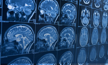 MRI images used to diagnose disease - iStock photo